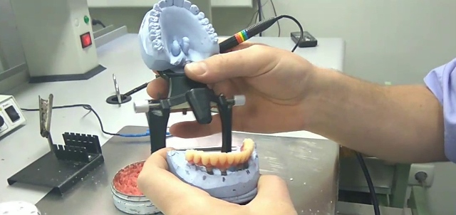 Лабораторная перебазировка зубного протеза